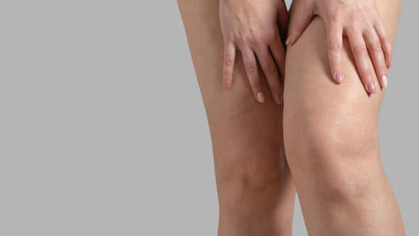 Schwere Beine: Ursachen, Symptome und praktische SofortTipps - Venen Engel Shop