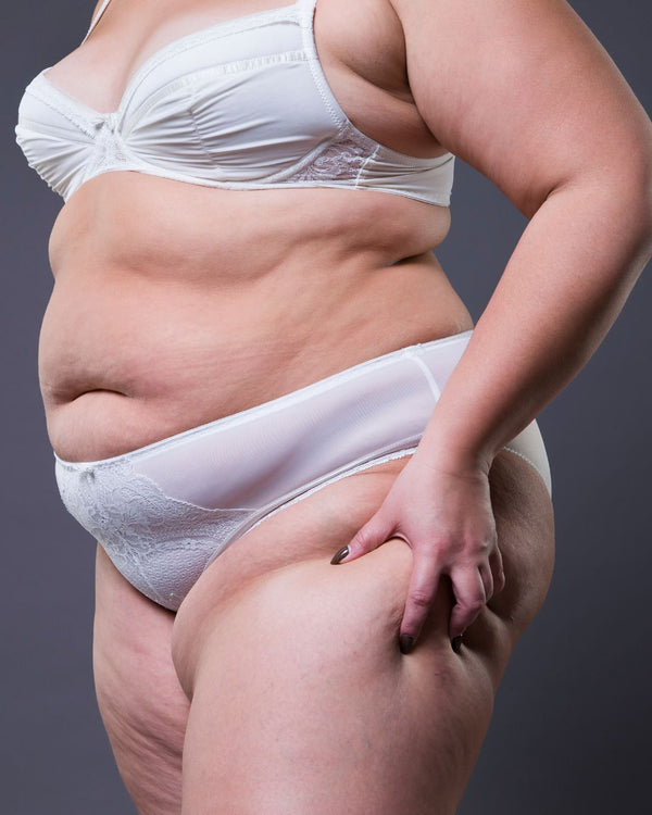 Lipödem-Kolumne Teil 7