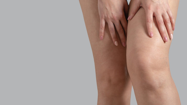 Schwere Beine: Ursachen, Symptome und praktische SofortTipps - Venen Engel Shop