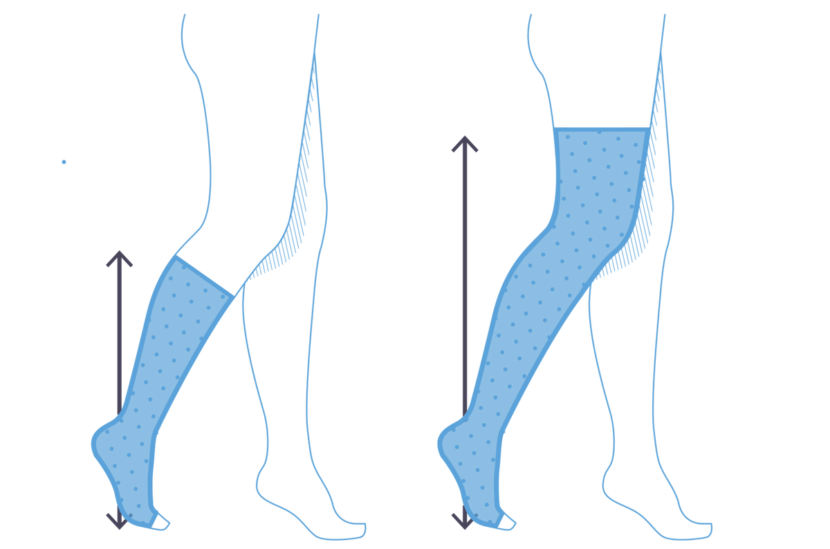 Venen Engel: Grafik 2 paar Beine, Kompressionssocken Knie vs Kompressionssocken Schenkel